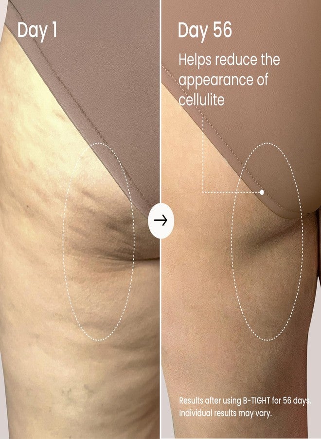 Maelys MAËLYS B-TIGHT Lift & Firm Booty Mask - Skin Tightening & Firming Cream for Booty & Thighs - Cellulite Cream with Caffeine & Brazilian Peppertree - Butt Mask for Smooth-Looking Skin (3.4 Fl Oz) - Image 3